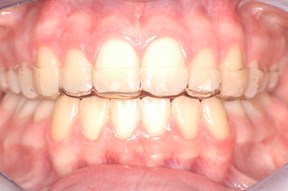clearretFOTO1.jpg