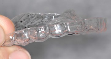 clearretFOTO2.jpg